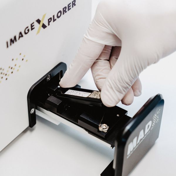 In hygienische Handschuhe gehüllte Hände einer Medizinischen Fachangestellten bedienen im mykologischen Labor unserer Hautarzt-Praxis ein Gerät zur PCR-Sequenzierung. Für die Allergie-Diagnose wird das DNA-Molekühl eines Patienten ausgewertet.