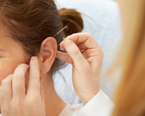 In the picture, a specialist doctor pricks a patient's ear with acupuncture needles. Acupuncture is used to correct disturbances in the flow of Qi in the private practice patient. Acupuncture is a branch of Chinese medicine, TCM.
