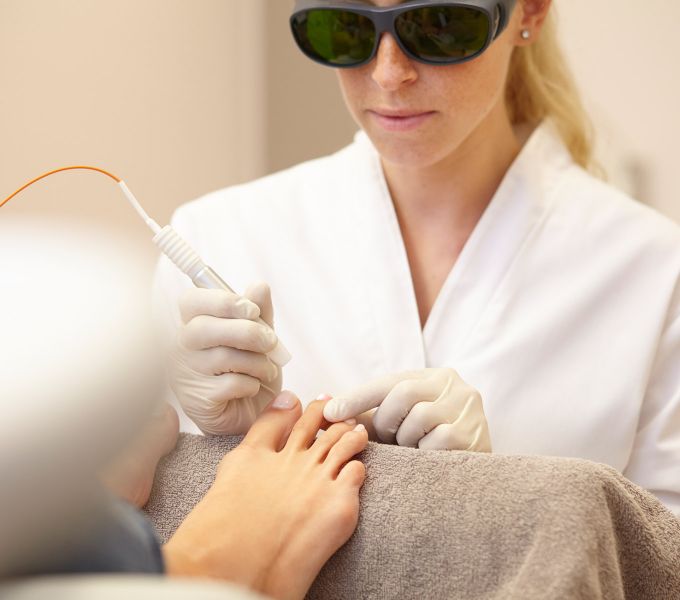 A patient undergoing podiatry treatment in the practice for dermatology and aesthetic medicine lies on a couch. Your beautiful feet will be treated on the nails by a podiatrist using laser technology. The podiatrist's eyes are protected by glasses.
