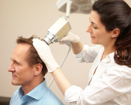 A doctor treats a patient with the meso gun (mesotherapy) against hair loss. The hair roots on the head of a male person are stimulated to grow through micro-injections of selected active ingredients.