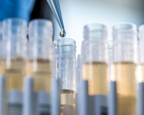 Vorbereitungen für eine Immuntherapie zur langfristigen Behandlung von Allergien im Labor der   dermatologischen Privatpraxis in Frankfurt am Main. Für die Hyposensibilisierung des Körpers werden in Reagenzgläser Flüssigkeiten mit einer Pipette getropft.