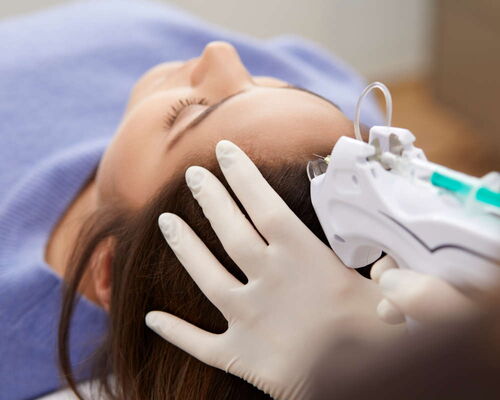 Während der Seffihair-Behandlung, einer regenerativen Haarwachstum-Therapie, werden einer Patientin stammzellenbasierende Wirkstoffe in die leicht betäubte Kopfhaut injiziert. In ein lila Pulli gehüllt, liegt sie entspannt auf einer Behandlungsliege.