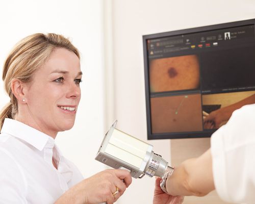 Dermatologist Ms. Dötterer-Rieg uses a video documentation system to examine the surface of the skin on a patient's arm. A conspicuous mole can be seen on the monitor. Early detection of skin changes prevents malignant skin cancer.