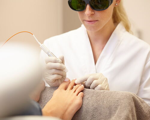 Fußnägel einer Patientin bei einer Nagelpilzentfernung mit Diodenlaser. Podologin in weißen Kittel gekleidet, behandelt den Nagelpilz an Fußnägeln mit Diodenlaser. Ihre Augen sind mit einer dunklen Schutzbrille bedeckt, Hände mit sterilen Handschuhen.