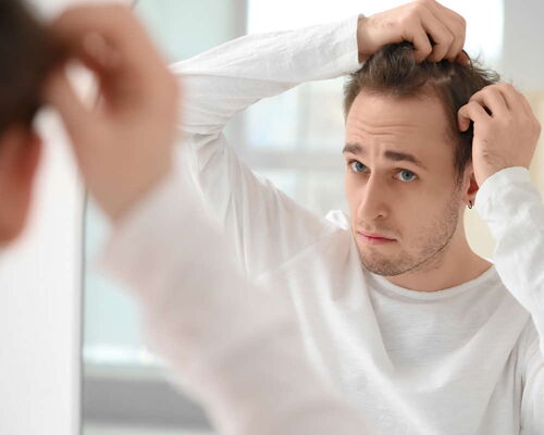 Vor einem Spiegel bei der Morgenhygiene durchforscht ein junger Mann die Geheimratsecken seiner braunen Kopfhaare. Nach einer PRP-Therapie gegen Haarausfall, einer Mesotherapie mit körpereigenen Blutplasma, hat sich sein Haarwuchs verbessert.